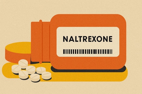 naltrexone